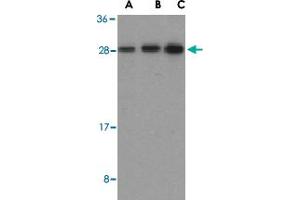 Western blot analysis of BID in mouse lung tissue lysates with BID polyclonal antibody  at (A) 0. (BID antibody  (C-Term))