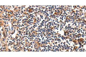 Immunohistochemistry of paraffin-embedded Human tonsil using FADD Polyclonal Antibody at dilution of 1:35 (FADD antibody)