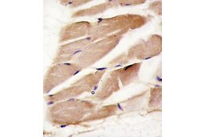 Formalin-fixed and paraffin-embedded human skeletal muscle reacted with PRK antibody (C-term) (ABIN391608 and ABIN2841530) , which was peroxidase-conjugated to the secondary antibody, followed by DAB staining. (PRKAA2 antibody  (C-Term))