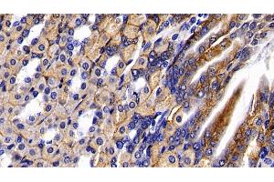 Immunohistochemistry (IHC) image for anti-Hexosaminidase B (Beta Polypeptide) (HEXB) (AA 315-456) antibody (ABIN7432289)