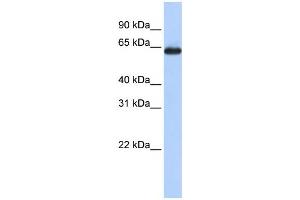 Western Blotting (WB) image for anti-Solute Carrier Family 34 (Sodium Phosphate), Member 3 (SLC34A3) antibody (ABIN2457906)