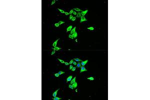 Immunofluorescence analysis of A549 cell using CD55 antibody. (CD55 antibody)