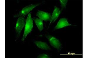 Immunofluorescence of purified MaxPab antibody to MSLN on HeLa cell. (Mesothelin antibody  (AA 1-621))