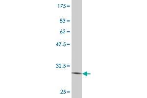 Western Blot detection against Immunogen (31. (Vasn antibody  (AA 298-349))