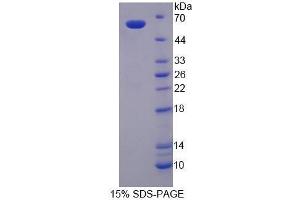 SDS-PAGE (SDS) image for Glucose-6-Phosphate Dehydrogenase (G6PD) (AA 1-515) protein (His tag,GST tag) (ABIN1099104)