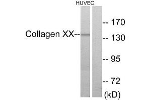 COL10A1 Antikörper  (C-Term)
