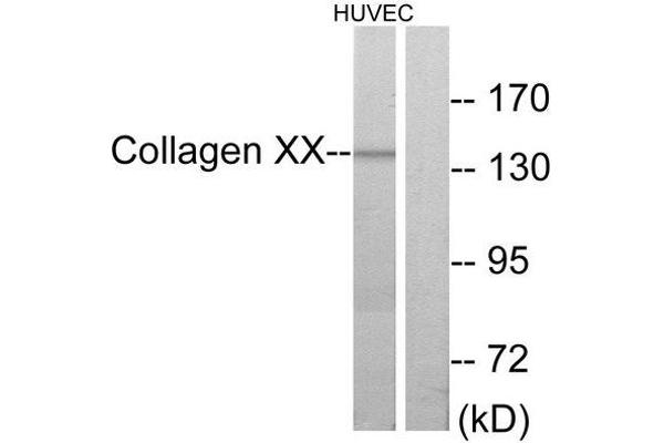 COL10A1 Antikörper  (C-Term)