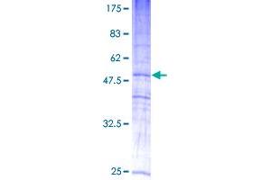 MAL2 Protein (AA 1-176) (GST tag)
