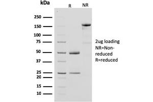 SDS-PAGE Analysis Purified CKBB Mouse Monoclonal Antibody (CPTC-CKB-2). (CKB antibody)