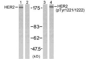Western blot analysis of extracts from SK-OV3 cells using HER2 (Ab-1221/1222) antibody (E021071, Line 1 and 2) and HER2 (phospho-Tyr1221/Tyr1222) antibody (E011076, Line 3 and 4). (ErbB2/Her2 antibody)
