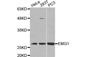 Western Blotting (WB) image for anti-EMG1 Nucleolar Protein Homolog (EMG1) antibody (ABIN1875902) (EMG1 antibody)