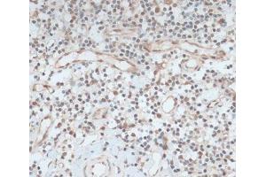 Immunohistochemistry of paraffin-embedded Human tonsil using ZNF416 Polyclonal Antibody at dilution of 1:100 (40x lens).