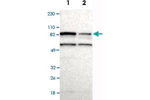 Western Blot analysis of Lane 1: RT-4 and Lane 2: U-251MG sp cell lysates with RPS6KA6 polyclonal antibody . (RPS6KA6 antibody)