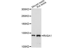 Western blot analysis of extracts of various cell lines, using RASA1 antibody (ABIN1874554) at 1:1000 dilution.