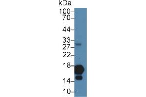 Detection of H3 in Human Cartilage lysate using Polyclonal Antibody to Histone H3 (H3) (Histone 3 antibody  (AA 1-136))