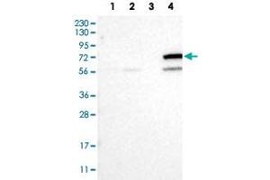 Western Blot analysis of Lane 1: RT-4 cell, Lane 2: U-251 MG sp cell, Lane 3: human plasma tissue (IgG/HSA depleted) and Lane 4: human liver tissue lysates with CYP4F11 polyclonal antibody .