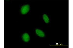 Immunofluorescence of purified MaxPab antibody to ASXL2 on HeLa cell. (ASXL2 antibody  (AA 1-918))