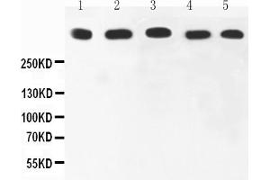 Anti-Ki67 Picoband antibody, All lanes: Anti-Ki67 at 0. (Ki-67 antibody  (AA 2860-3256))