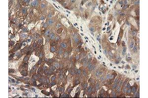 Image no. 1 for anti-Breast Cancer Anti-Estrogen Resistance 1 (BCAR1) antibody (ABIN1496834) (BCAR1 antibody)