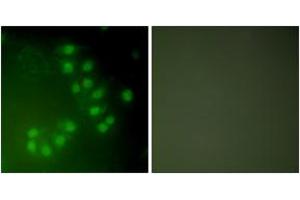Immunofluorescence analysis of A549 cells, using p63 Antibody.