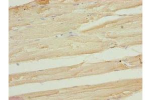 Immunohistochemistry of paraffin-embedded human skeletal muscle tissue using ABIN7167630 at dilution of 1:100 (FAM82B antibody  (AA 13-314))