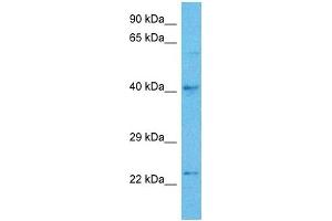 Host:  Mouse  Target Name:  TFAP2A  Sample Tissue:  Mouse Pancreas  Antibody Dilution:  1ug/ml (TFAP2C antibody  (Middle Region))