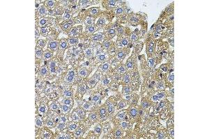 Immunohistochemistry of paraffin-embedded mouse liver using CETP antibody. (CETP antibody  (AA 300-493))