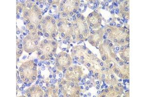 Immunohistochemistry of paraffin-embedded Rat kidney using ACY1 Polyclonal Antibody at dilution of 1:100 (40x lens). (Aminoacylase 1 antibody)