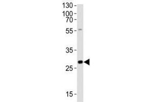 Western blot analysis of lysate from rat liver tissue lysate using Olig3 antibody at 1:1000. (OLIG3 antibody  (AA 70-103))