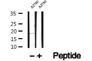 Western blot analysis of extracts of A2780 cells, using TMEM70 antibody.
