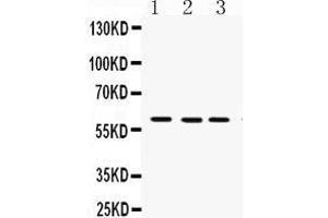 Western Blotting (WB) image for anti-Flavin Containing Monooxygenase 3 (FMO3) (AA 404-433), (C-Term) antibody (ABIN3043830) (FMO3 antibody  (C-Term))