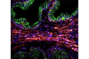 Confocal immunofluorescent analysis of Cytokeratin-18 antibody with prostate carcinoma followed by Alexa Fluor 488-conjugated goat anti-rabbit lgG (green). (Cytokeratin 18 antibody  (AA 401-430))