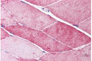 Human Skeletal Muscle (formalin-fixed, paraffin-embedded) stained with CAV3 antibody ABIN214088 at 5 ug/ml followed by biotinylated goat anti-rabbit IgG secondary antibody ABIN481713, alkaline phosphatase-streptavidin and chromogen. (Caveolin 3 antibody  (N-Term))