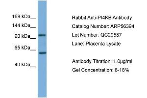 WB Suggested Anti-PI4KB  Antibody Titration: 0. (PI4KB antibody  (Middle Region))