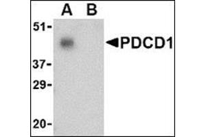 Western blot analysis of PD-1 in THP-1 cell lysate with AP30650PU-N PD1 antibody at 1 μg/ml in the (A) absence and (B) presence of blocking peptide.