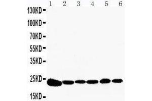 Anti-Peroxiredoxin 2 antibody, Western blotting Lane 1: Rat Brain Tissue Lysate Lane 2: Rat Kidney Tissue Lysate Lane 3: HELA Cell Lysate Lane 4: JURKAT Cell Lysate Lane 5: 293T Cell Lysate Lane 6: A549 Cell Lysate (Peroxiredoxin 2 antibody  (C-Term))