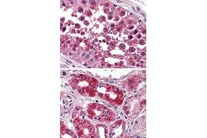 Immunohistochemical (Formalin/PFA-fixed paraffin-embedded sections) staining in human testis (A) and human kidney (B) with NPSR1 polyclonal antibody . (NPSR1 antibody  (2nd Extracellular Domain))