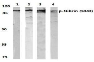 Image no. 1 for anti-Nibrin (NBN) (pSer343) antibody (ABIN318326) (Nibrin antibody  (pSer343))