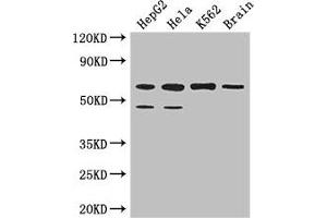 Western Blot Positive WB detected in: HepG2 whole cell lysate, Hela whole cell lysate, K562 whole cell lysate, Mouse brain tissue All lanes: PAF1 antibody at 3. (PAF1/PD2 antibody  (AA 1-300))