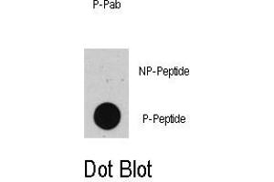 Image no. 1 for anti-Tumor Protein P53 (TP53) (pThr55) antibody (ABIN358423) (p53 antibody  (pThr55))