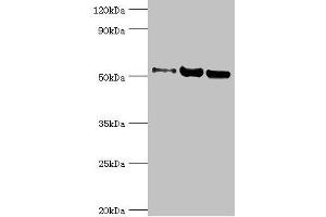 Western blot All lanes: Carbonic anhydrase 1 antibody at 2 μg/mL Lane 1: HepG2 whole cell lysate Lane 2: 293T whole cell lysate Lane 3: 293T whole cell lysate Secondary Goat polyclonal to rabbit IgG at 1/10000 dilution Predicted band size: 53, 14 kDa Observed band size: 53 kDa (G3BP1 antibody  (AA 227-466))