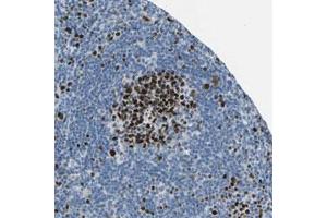 Immunohistochemical staining (Formalin-fixed paraffin-embedded sections) of human lymph node with MCM4 polyclonal antibody  shows strong nuclear positivity in cells in reaction center. (MCM4 antibody)