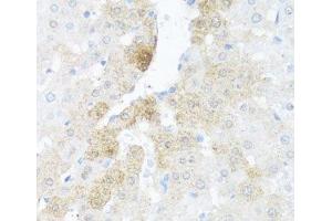 Immunohistochemistry of paraffin-embedded Rat liver using BCL2L2 Polyclonal Antibody at dilution of 1:100 (40x lens). (BCL2L2 antibody)