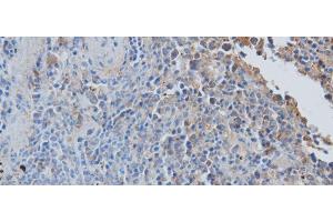 Immunohistochemistry of paraffin-embedded Rat spleen using CCL7 Polyclonal Antibody at dilution of 1:50 (CCL7 antibody)