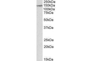 AP22387PU-N LMTK2 antibody staining of Human Cerebellum lysate at 2 µg/ml (35µg protein in RIPA buffer). (LMTK2 antibody  (Internal Region))