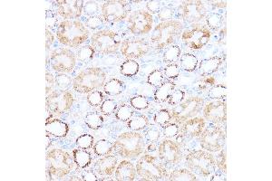 Immunohistochemistry (IHC) image for anti-Acetyl-CoA Acetyltransferase 1 (ACAT1) (AA 1-145) antibody (ABIN6136413)