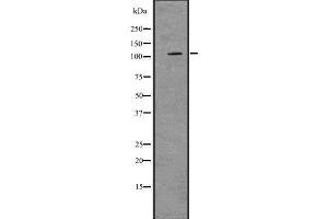 Western blot analysis of PRKD2 using LOVO whole  lysates. (PKD2 antibody  (N-Term))