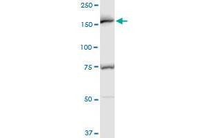 EEA1 polyclonal antibody (A01), Lot # 060717JCS1. (EEA1 antibody  (AA 1312-1411))
