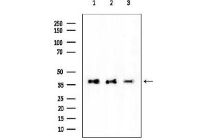 anti-Acyl-CoA Wax Alcohol Acyltransferase 2 (AWAT2) (Internal Region) antibody