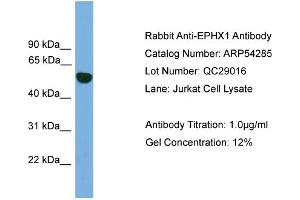 WB Suggested Anti-EPHX1  Antibody Titration: 0. (EPHX1 antibody  (N-Term))
